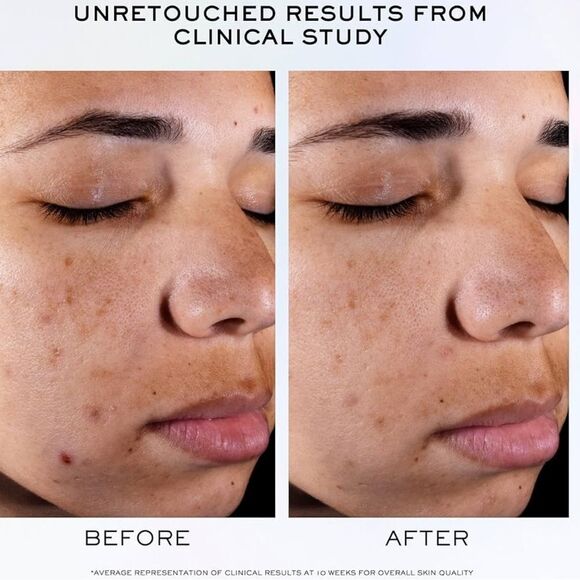 Lancôme Clarifique Refining Brightening Pro-Solution New FullSz 1oz - Picture 6 of 8